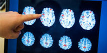 La zone clé du cerveau pour reconnaître les visages grossit jusqu'à l'âge adulte La zone clé du cerveau pour reconnaître les visages grossit jusqu'à l'âge adulte