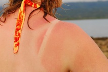 Découverte d'une substance pour bronzer sans être au soleil Découverte d'une substance pour bronzer sans être au soleil