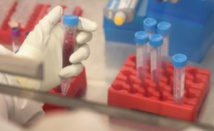 Une nouvelle molécule "prometteuse" contre la douleur Une nouvelle molécule "prometteuse" contre la douleur