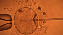 Des ovules créés en laboratoire à partir de cellules souches