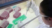 Des virus plus cléments avec les femmes qu'avec les hommes