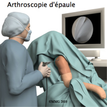 Les nouvelles techniques thérapeutiques en arthroscopie disséquées à Marrakech Les nouvelles techniques thérapeutiques en arthroscopie disséquées à Marrakech