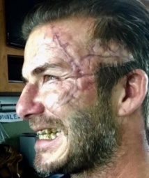 David Beckham défiguré pour les besoins du prochain film de Guy Ritchie