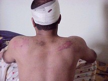 Lutte contre la torture : Le Maroc tend vers la ratification du protocole facultatif Lutte contre la torture : Le Maroc tend vers la ratification du protocole facultatif