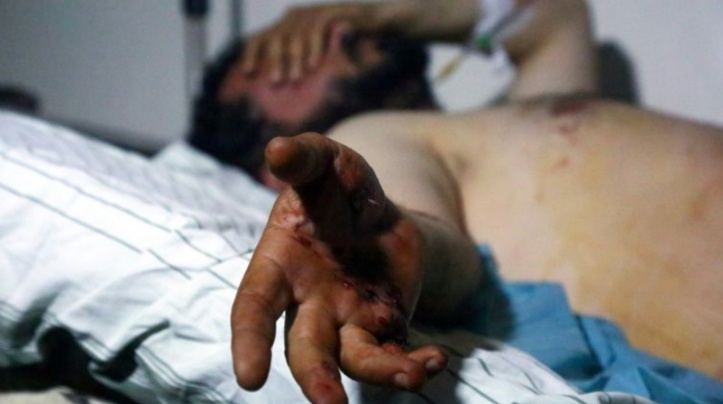 Cinq morts dans l'explosion d'une voiture piégée dans le nord de la Syrie Cinq morts dans l'explosion d'une voiture piégée dans le nord de la Syrie