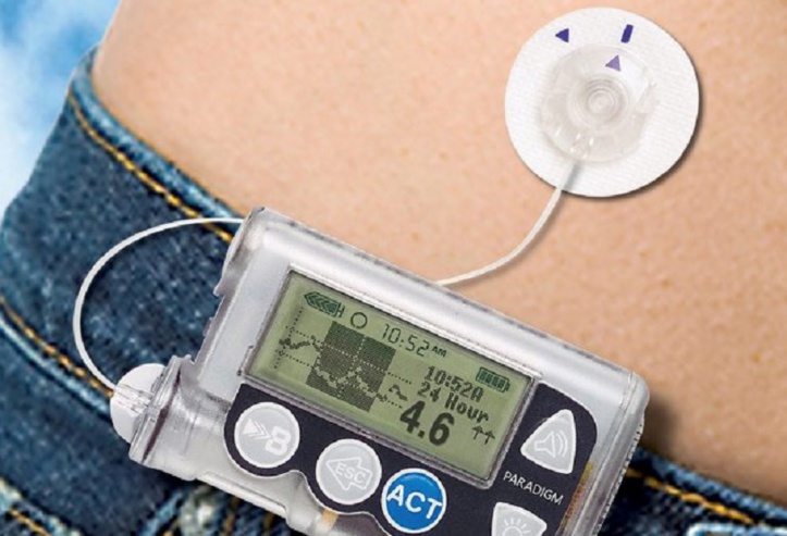 La pompe insuline désormais commercialisée au Maroc La pompe insuline désormais commercialisée au Maroc