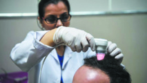 Les greffes de cheveux au secours du tourisme à Istanbul Les greffes de cheveux au secours du tourisme à Istanbul