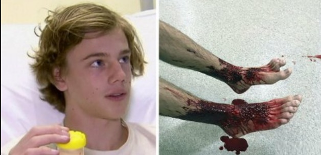 Insolite : Baignade sanglante Insolite : Baignade sanglante