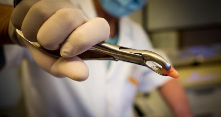 S.O.S. la pratique illégale de la médecine dentaire tue S.O.S. la pratique illégale de la médecine dentaire tue