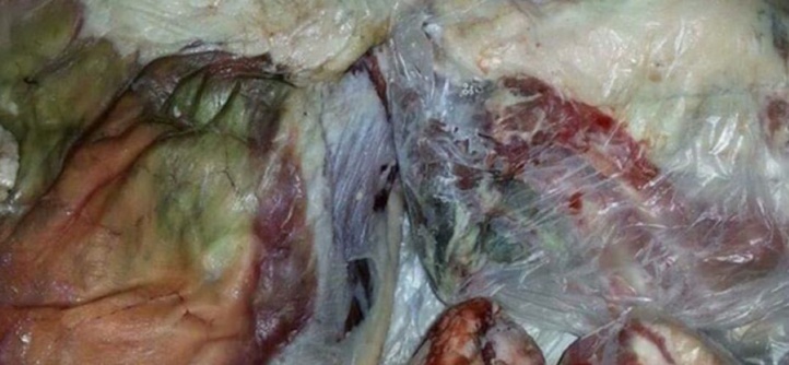 Clarification de l’ONSSA sur la teinte verdâtre de la carcasse de l’Aïd Al-Adha Clarification de l’ONSSA sur la teinte verdâtre de la carcasse de l’Aïd Al-Adha