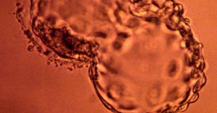 Une maladie du sang corrigée chez l'embryon Une maladie du sang corrigée chez l'embryon