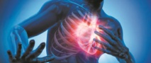 La grippe accroît fortement le risque de crise cardiaque La grippe accroît fortement le risque de crise cardiaque