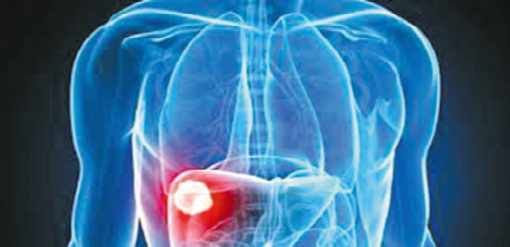 1,25 million de Marocains sont atteints par le virus de l’hépatite C et l’hépatite B 1,25 million de Marocains sont atteints par le virus de l’hépatite C et l’hépatite B