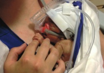 Un test sanguin peut prédire une naissance prématurée Un test sanguin peut prédire une naissance prématurée