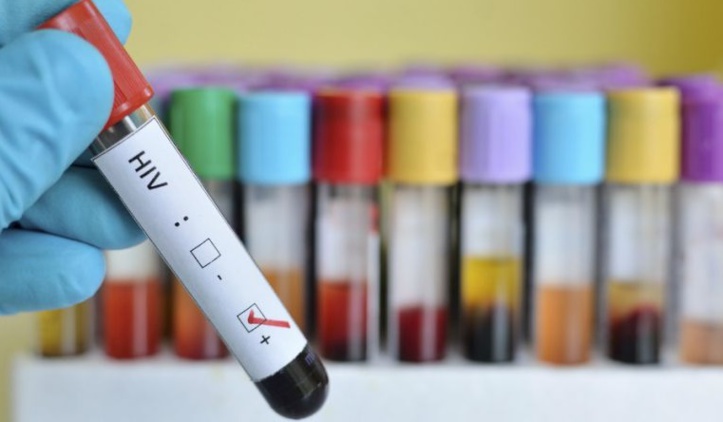 Identification d’une piste pour éliminer les réservoirs du VIH Identification d’une piste pour éliminer les réservoirs du VIH