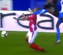 Mehdi Carcela souffre de fractures au visage sans aucune atteinte cérébrale Mehdi Carcela souffre de fractures au visage sans aucune atteinte cérébrale