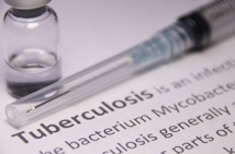 Possibilité d’éradiquer la tuberculose en 25 ans