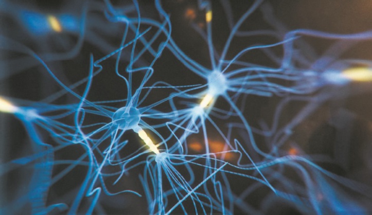 Quand un implant cérébral transforme les pensées en paroles Quand un implant cérébral transforme les pensées en paroles