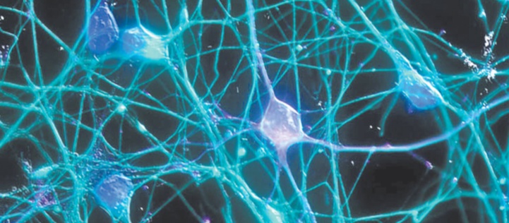 La sclérose en plaques demeure énigmatique La sclérose en plaques demeure énigmatique