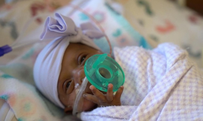 Insolite : 245 grammes à la naissance Insolite : 245 grammes à la naissance