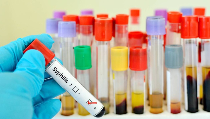 La syphilis regagne du terrain