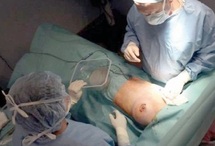 Les prothèses mammaires PIP, une affaire aux ramifications mondiales Les prothèses mammaires PIP, une affaire aux ramifications mondiales