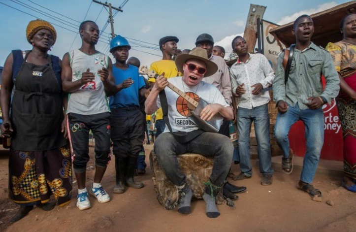Au Malawi, un "fils" de Salif Keita au service de la cause albinos Au Malawi, un "fils" de Salif Keita au service de la cause albinos