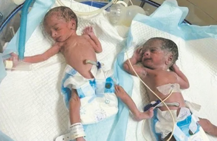 En Inde, une femme de 74 ans donne naissance à des jumelles En Inde, une femme de 74 ans donne naissance à des jumelles