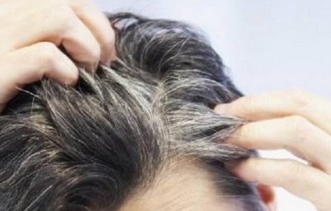 Pourquoi le stress favorise l'apparition de cheveux blancs