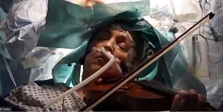 Insolite : Pour sauver sa main Insolite : Pour sauver sa main