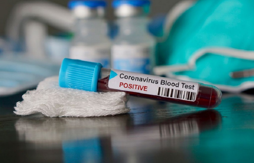 Nouveau cas de coronavirus à Marrakech