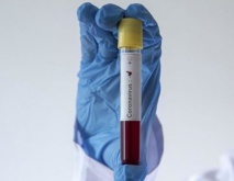 Deux nouveaux cas d'infection au Covid-19 Deux nouveaux cas d'infection au Covid-19