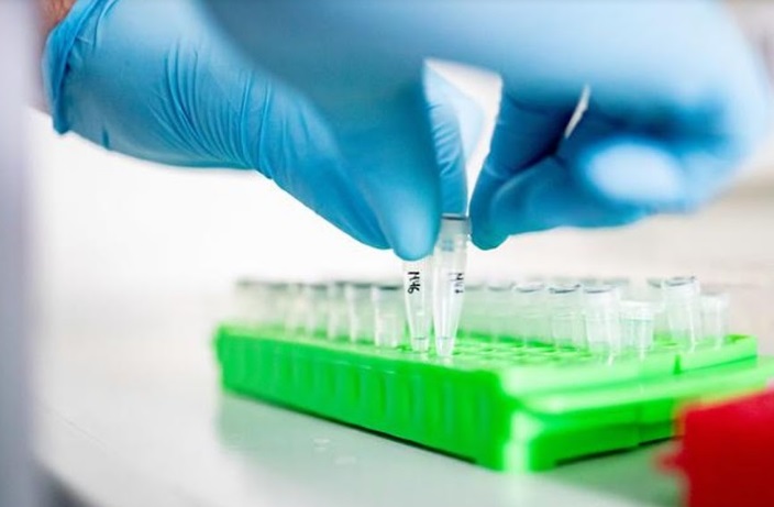 Une étude confirme l'efficacité modeste d'un antiviral contre le Covid-19 Une étude confirme l'efficacité modeste d'un antiviral contre le Covid-19