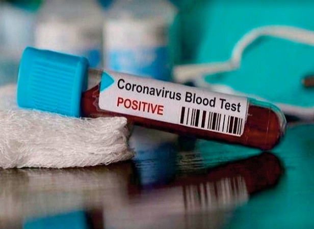 ​Des chiffres en furie : Le Covid se déchaîne
