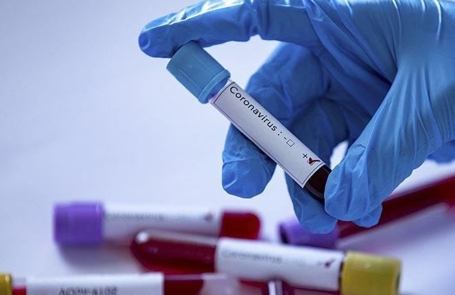 La situation épidémiologique oscille entre inquiétude et optimisme La situation épidémiologique oscille entre inquiétude et optimisme