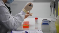 Qu’on se le dise ! Le test sérologique vient en complément du PCR