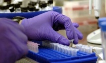 28.000 nouveaux cas de tuberculose déclarés annuellement : La maladie du pauvre gagne du terrain 28.000 nouveaux cas de tuberculose déclarés annuellement : La maladie du pauvre gagne du terrain