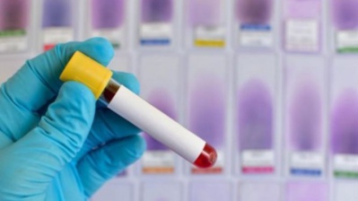 SOS: Le variant britannique s’invite chez-nous SOS: Le variant britannique s’invite chez-nous