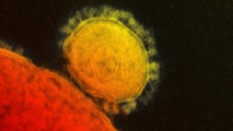 Le Coronavirus représente-t-il un danger pour les candidats au pèlerinage ? Le Coronavirus représente-t-il un danger pour les candidats au pèlerinage ?