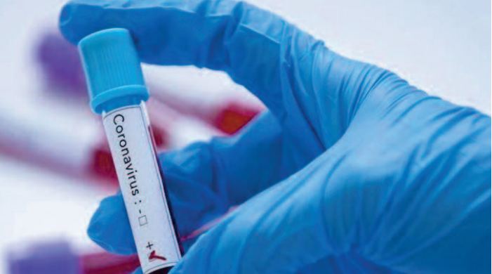 La propagation de l’épidémie inquiète le ministère de la Santé La propagation de l’épidémie inquiète le ministère de la Santé