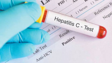 Première enquête nationale de séroprévalence au Maroc Première enquête nationale de séroprévalence au Maroc