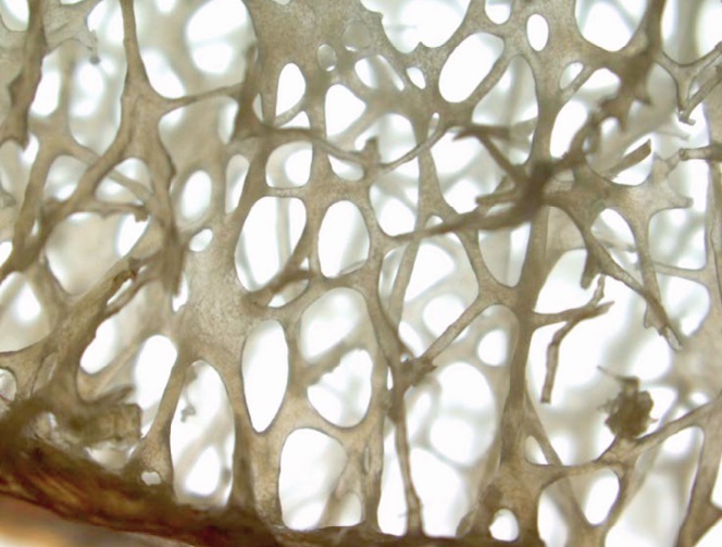 L’ostéoporose touche  30% de Marocains L’ostéoporose touche  30% de Marocains