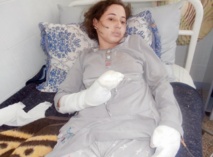 Une femme sauvagement agressée par son mari Une femme sauvagement agressée par son mari