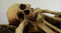 Il y a 15 000 ans, les hommes préhistoriques souffraient déjà de problèmes dentaires Il y a 15 000 ans, les hommes préhistoriques souffraient déjà de problèmes dentaires