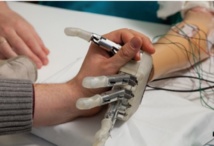 Une main bionique dotée du sens du toucher ! Une main bionique dotée du sens du toucher !