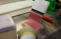 Des cellules immunitaires, génétiquement modifiées, efficaces contre le sida Des cellules immunitaires, génétiquement modifiées, efficaces contre le sida