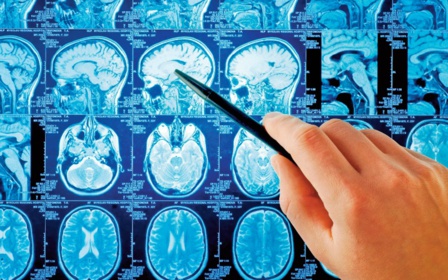 Le Covid-19 favoriserait un vieillissement de 20 ans de nos capacités cognitives Le Covid-19 favoriserait un vieillissement de 20 ans de nos capacités cognitives