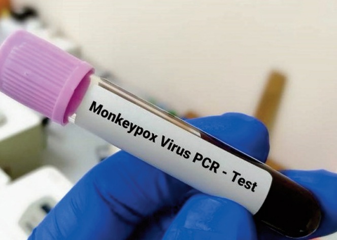 Les trois cas suspects de variole de singe détectés au Maroc sont négatifs