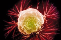 Une nouvelle méthode d'immunothérapie cible les cellules cancéreuses mutantes Une nouvelle méthode d'immunothérapie cible les cellules cancéreuses mutantes