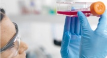 Un cancer guéri par une dose massive de virus modifiés de la rougeole Un cancer guéri par une dose massive de virus modifiés de la rougeole